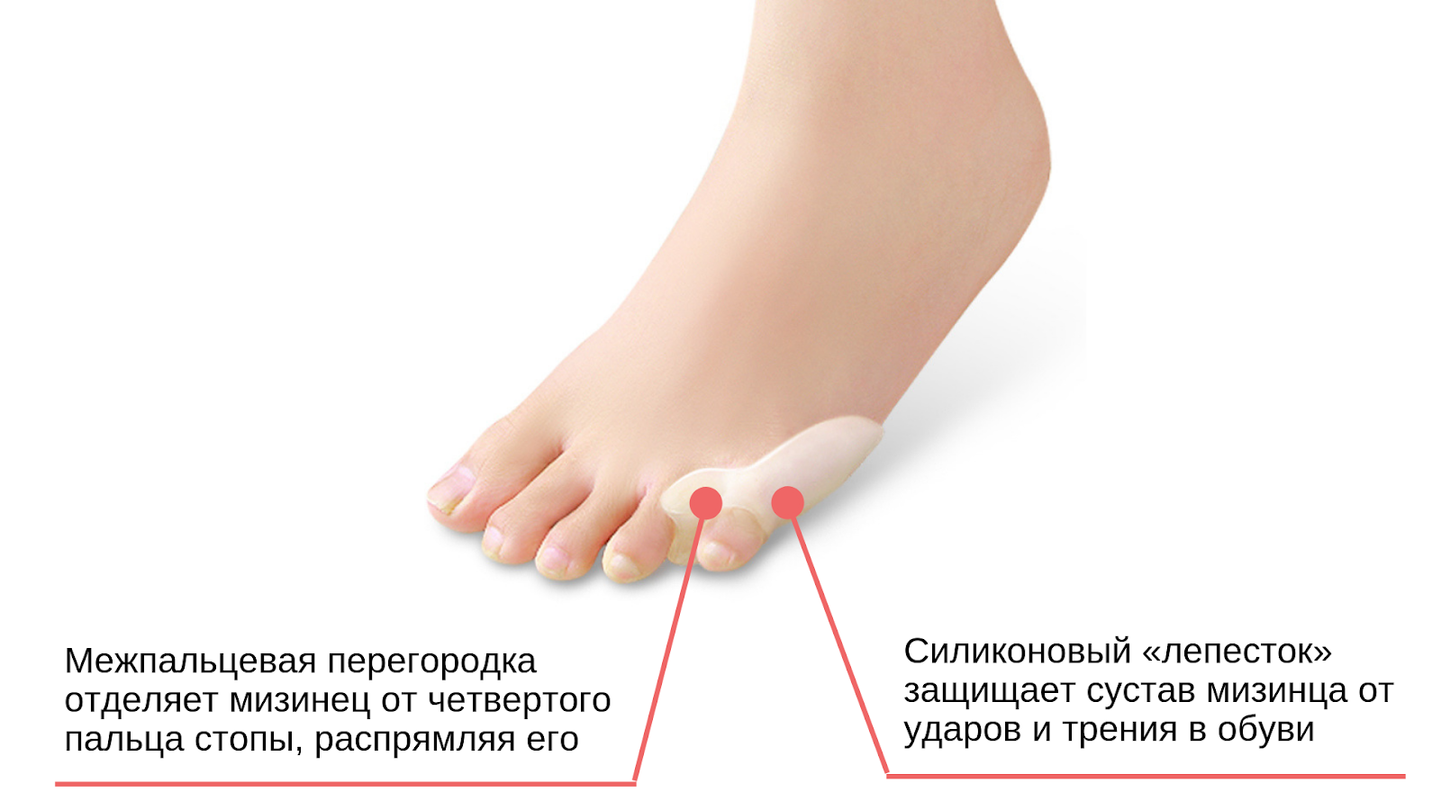 Причины болят пальцы на ногах почему