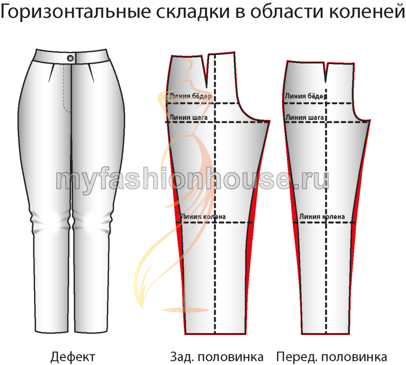 Исправление дефектов брюк