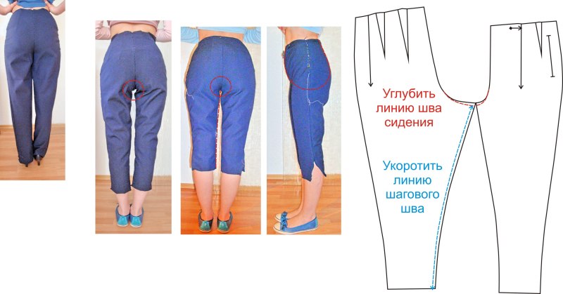 Дефекты посадки брюк