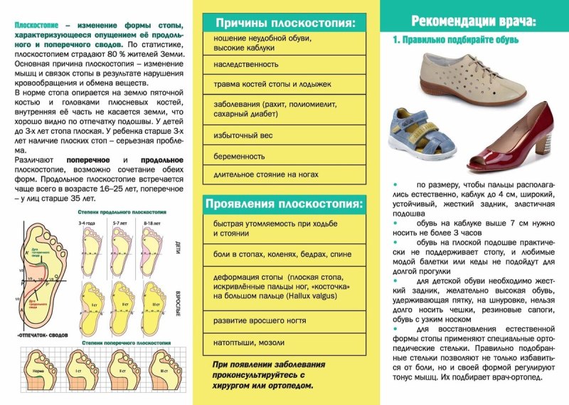 Памятка для ребенка при плоскостопии